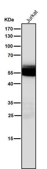 Anti-Lck Monoclonal Antibody Boster Bio