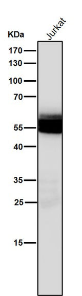 Anti-Lck Monoclonal Antibody Boster Bio
