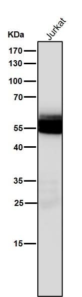 Anti-Lck Monoclonal Antibody Boster Bio