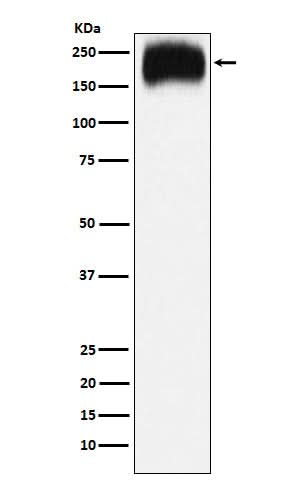 Anti-Niemann Pick C1 Rabbit Monoclonal Antibody Boster Bio