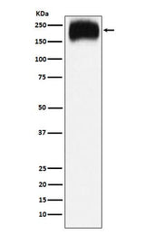 Anti-Niemann Pick C1 Rabbit Monoclonal Antibody Boster Bio