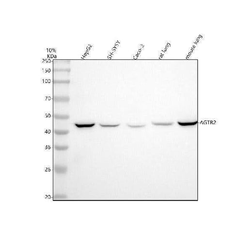 Anti-AGTR2/Angiotensin Ii Type 2 Receptor Rabbit Monoclonal Antibody Boster Bio