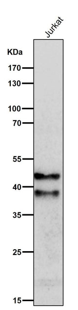 Anti-SIRT2/Sirtuin 2 Rabbit Monoclonal Antibody Boster Bio