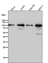 Anti-TOP1/Topoisomerase I Rabbit Monoclonal Antibody Boster Bio