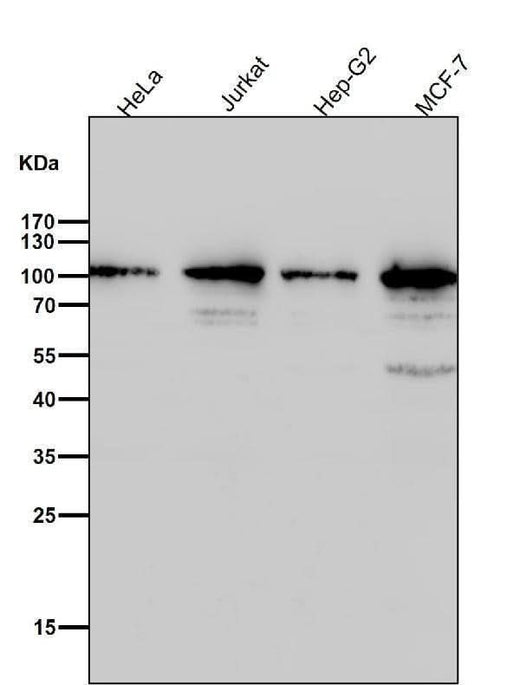 Anti-TOP1/Topoisomerase I Rabbit Monoclonal Antibody Boster Bio