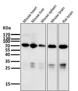 Anti-Raf1 Rabbit Monoclonal Antibody Boster Bio