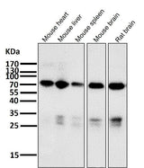 Anti-Raf1 Rabbit Monoclonal Antibody Boster Bio