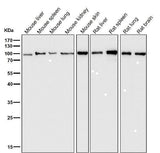 Anti-Insulin Receptor INSR Rabbit Monoclonal Antibody Boster Bio