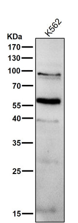 Anti-PPAR gamma Rabbit Monoclonal Antibody Boster Bio