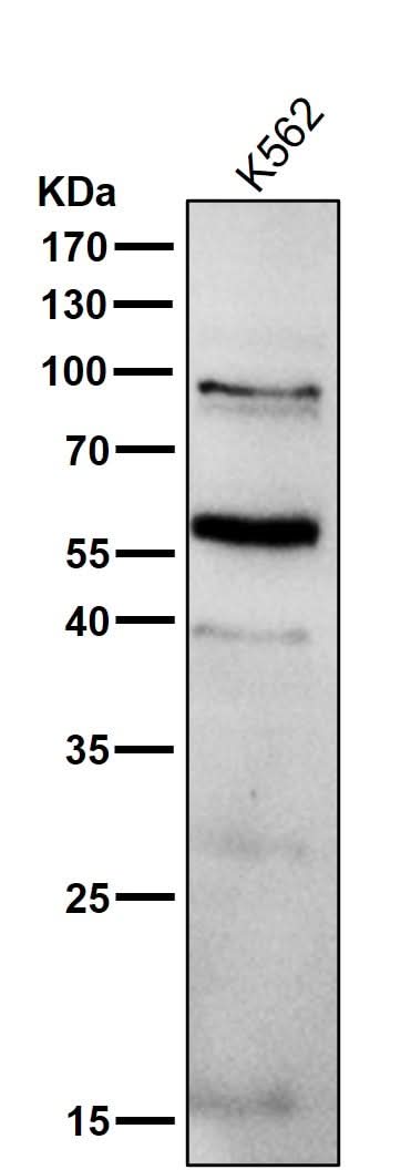 Anti-PPAR gamma Rabbit Monoclonal Antibody Boster Bio