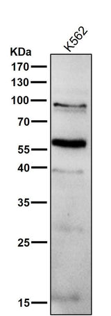 Anti-PPAR gamma Rabbit Monoclonal Antibody Boster Bio