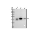 Anti-Lipocalin-2 LCN2 Rabbit Monoclonal Antibody Boster Bio