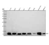 Anti-beta 2 Microglobulin B2M Rabbit Monoclonal Antibody Boster Bio
