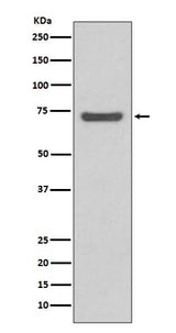Anti-ABCG2/Bcrp Rabbit Monoclonal Antibody Boster Bio