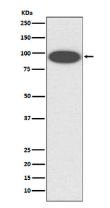 Anti-CD18 ITGB2 Rabbit Monoclonal Antibody Boster Bio