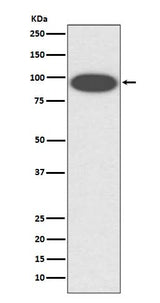 Anti-CD18 ITGB2 Rabbit Monoclonal Antibody Boster Bio