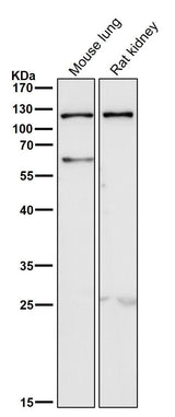 Anti-TLR5 Rabbit Monoclonal Antibody Boster Bio