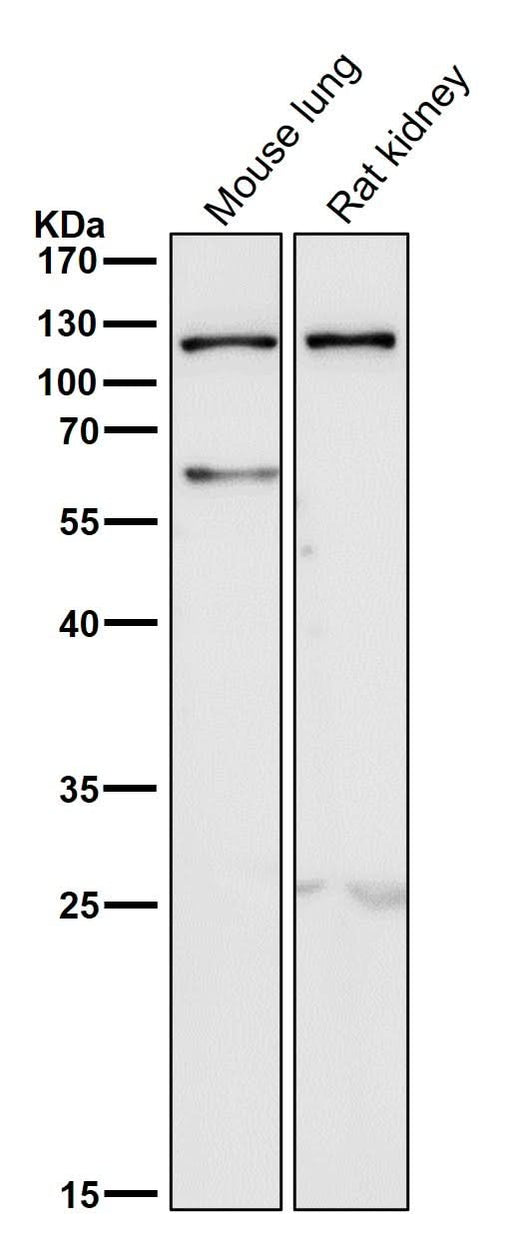 Anti-TLR5 Rabbit Monoclonal Antibody Boster Bio