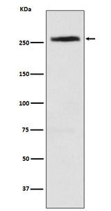 Anti-CAD Rabbit Monoclonal Antibody Boster Bio