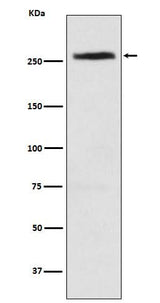 Anti-CAD Rabbit Monoclonal Antibody Boster Bio