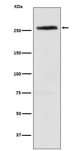 Anti-CAD Rabbit Monoclonal Antibody Boster Bio