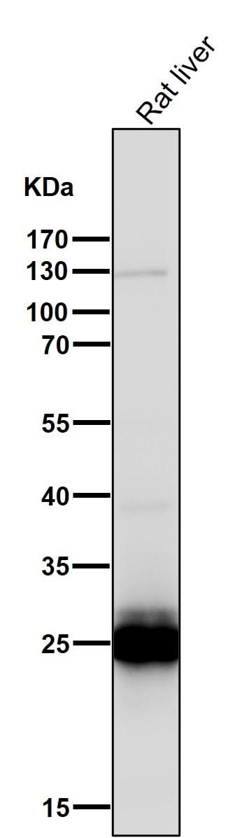 Anti-COMT Rabbit Monoclonal Antibody Boster Bio