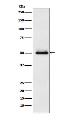 Anti-Cytochrome P450 2C9 Rabbit Monoclonal Antibody Boster Bio