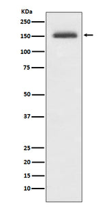 Anti-Integrin alpha 4 ITGA4 Rabbit Monoclonal Antibody Boster Bio