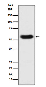 Anti-SERPINC1 Monoclonal Antibody Boster Bio
