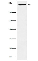 Anti-ApoA Rabbit Monoclonal Antibody Boster Bio