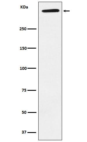 Anti-ApoA Rabbit Monoclonal Antibody Boster Bio