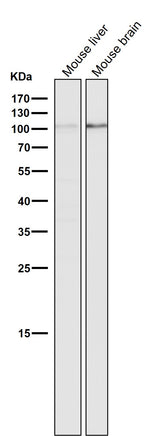 Anti-DGCR8 Rabbit Monoclonal Antibody Boster Bio