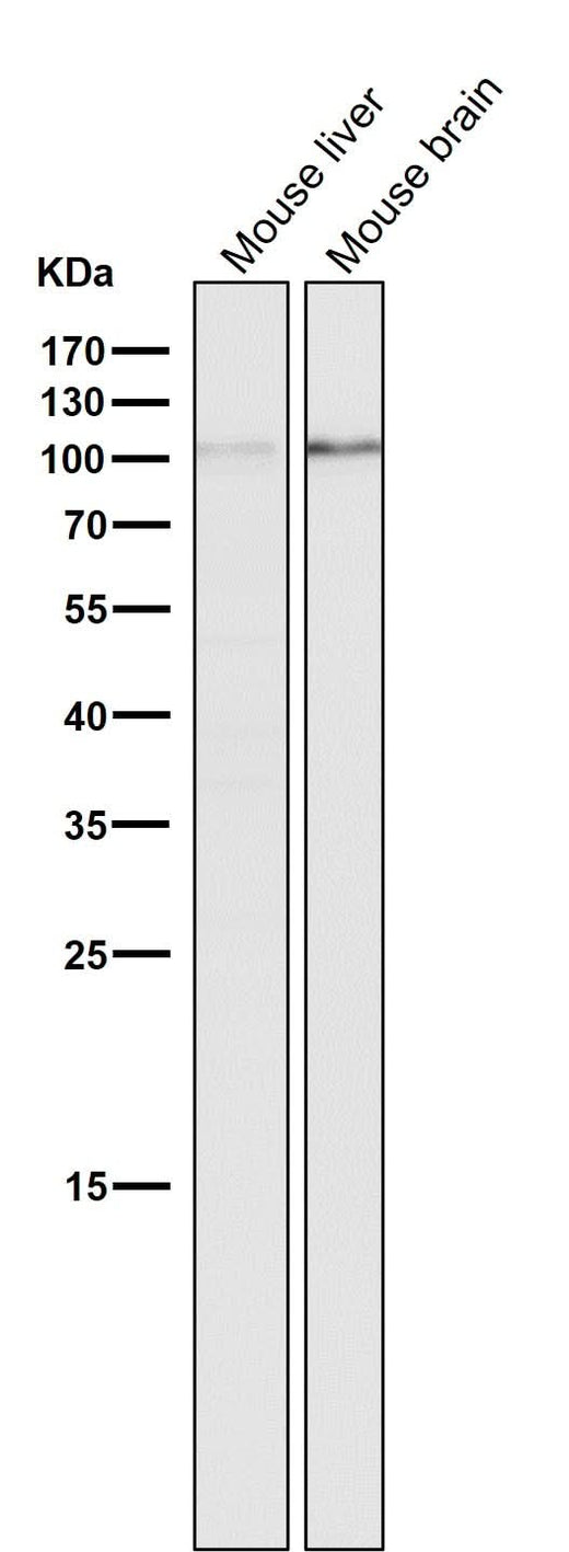 Anti-DGCR8 Rabbit Monoclonal Antibody Boster Bio