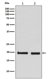 Anti-Skp1 Monoclonal Antibody Boster Bio