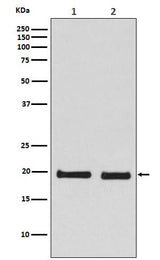 Anti-Skp1 Monoclonal Antibody Boster Bio