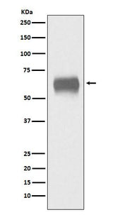 Anti-CD5 Monoclonal Antibody Boster Bio