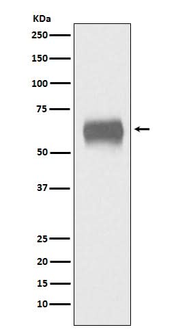 Anti-CD5 Monoclonal Antibody Boster Bio