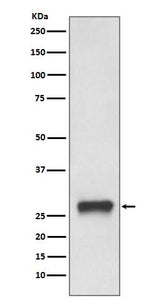 Anti-MHC Class II HLA-DPB1 Rabbit Monoclonal Antibody Boster Bio