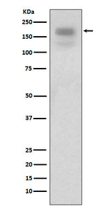 Anti-MERTK/Mer Rabbit Monoclonal Antibody Boster Bio