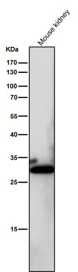 Anti-NQO1/Dt Diaphorase Rabbit Monoclonal Antibody Boster Bio