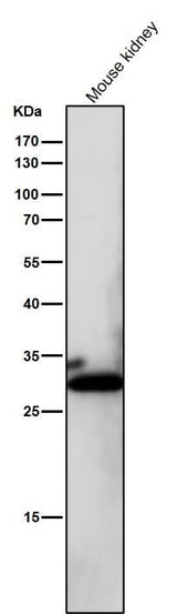 Anti-NQO1/Dt Diaphorase Rabbit Monoclonal Antibody Boster Bio