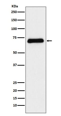 Anti-Serotonin transporter Rabbit Monoclonal Antibody Boster Bio
