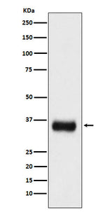 Anti-SF2 Monoclonal Antibody Boster Bio