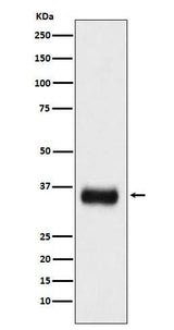 Anti-SF2 Monoclonal Antibody Boster Bio