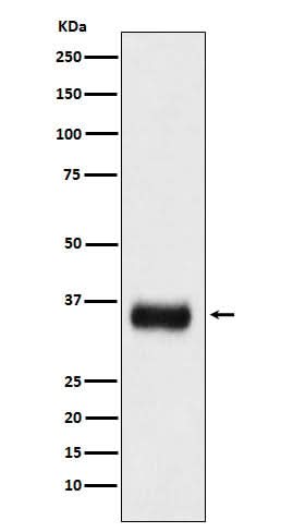 Anti-SF2 Monoclonal Antibody Boster Bio