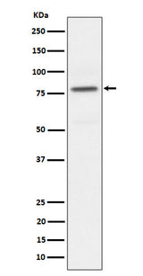 Anti-Phospho-PKC alpha (T497) Rabbit Monoclonal Antibody Boster Bio