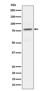 Anti-Phospho-PKC alpha (T497) Rabbit Monoclonal Antibody Boster Bio
