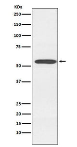 Anti-Cytochrome P450 2D6 CYP2D6 Monoclonal Antibody Boster Bio