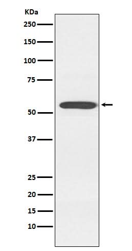 Anti-Cytochrome P450 2D6 CYP2D6 Monoclonal Antibody Boster Bio