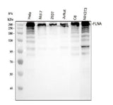 Anti-Filamin A FLNA Rabbit Monoclonal Antibody Boster Bio